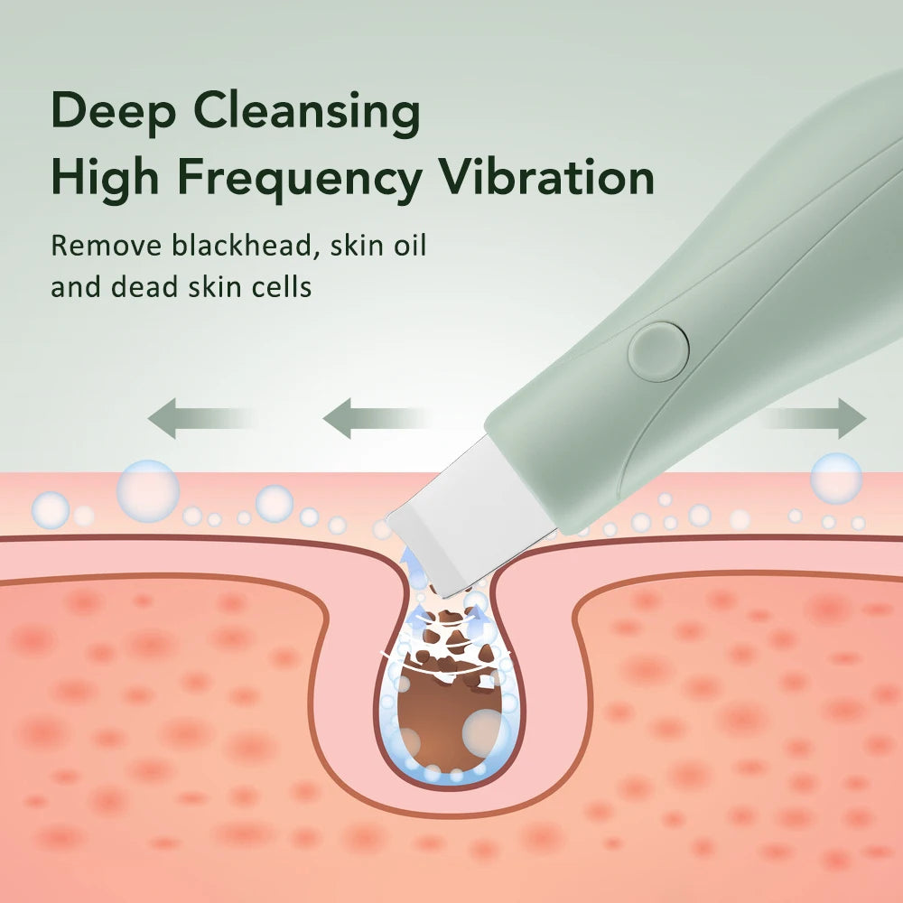 Vibration Face Skin Scrubber Ultrasonic Blackhead Remover-Deep Clean Pore Cleaner Lifting Facial Tool with Spatula for Skin Care